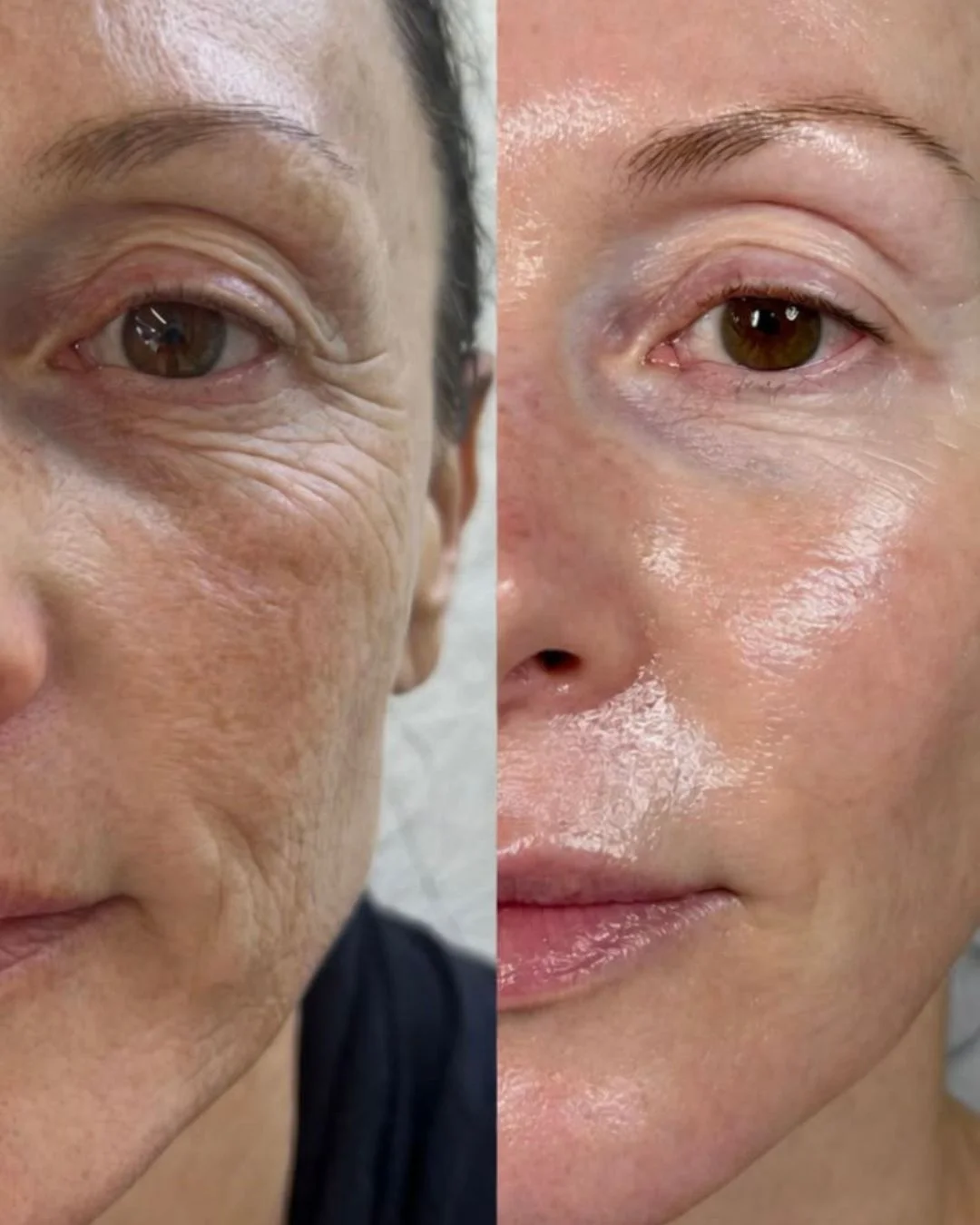 Masaje facial Sakura